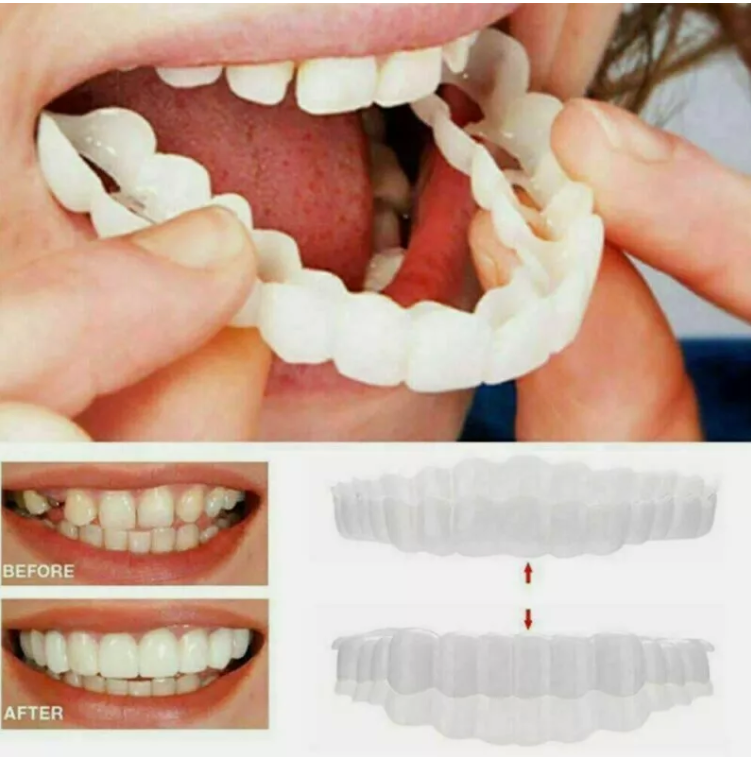 Set 2 x Proteza Dentara tip Fatete Dentare, Dinti Falsi Realisti